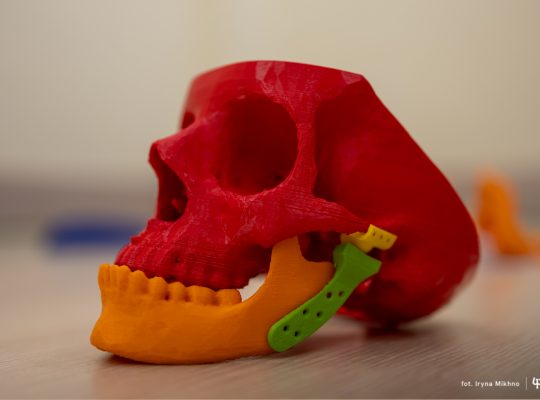 Politechnika Białostocka  zgłosiła patent na implant stawu skroniowo-żuchwowego