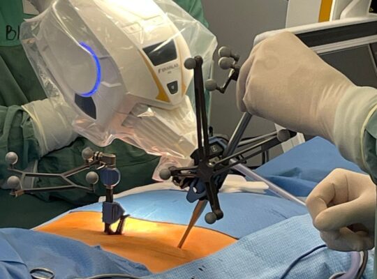 Białystok. Roboty do operacji neurochirurgicznych kupił Uniwersytecki Szpital Kliniczny