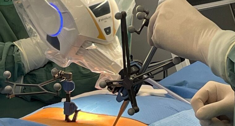 Białystok. Roboty do operacji neurochirurgicznych kupił Uniwersytecki Szpital Kliniczny